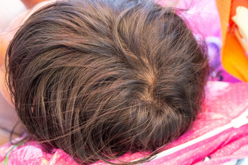 Head of sleeping kid