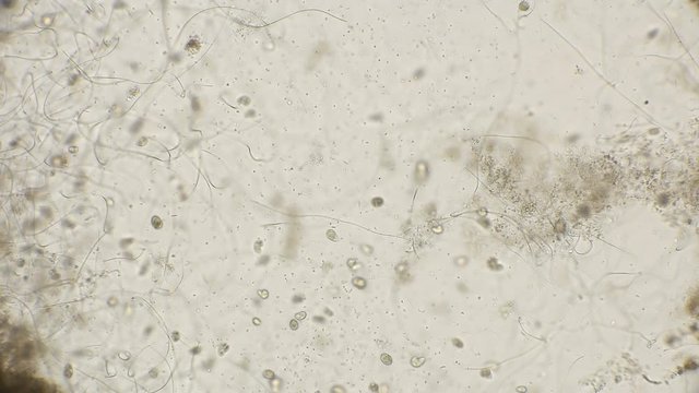 ciliates Colpoda class Colpodea cultivated with a banana peel, under a microscope