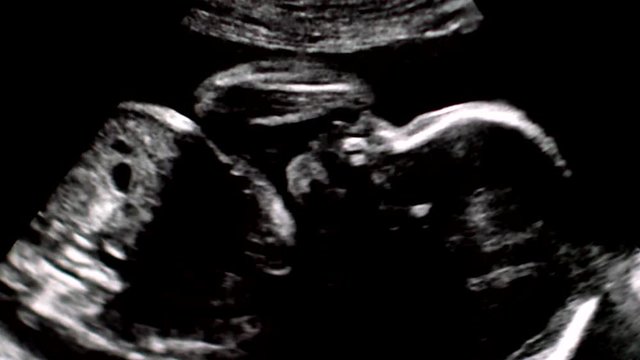 Footage of ultrasonography of second trimester pregnancy.