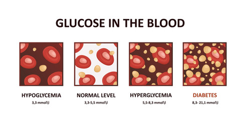 Glucose levels in the blood diagram - hyperglycemia, hypoglycemia, diabetes