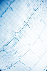 Electrocardiogram close up
