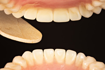 Tongue depressor in mouth seen from inside the mouth