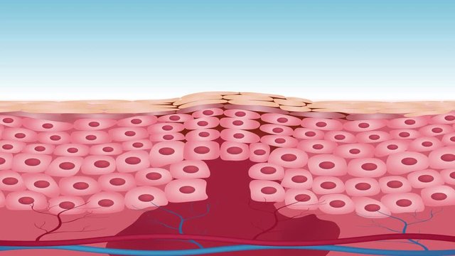 bruised , wound skin graphic animation . the blood almost come out of wound