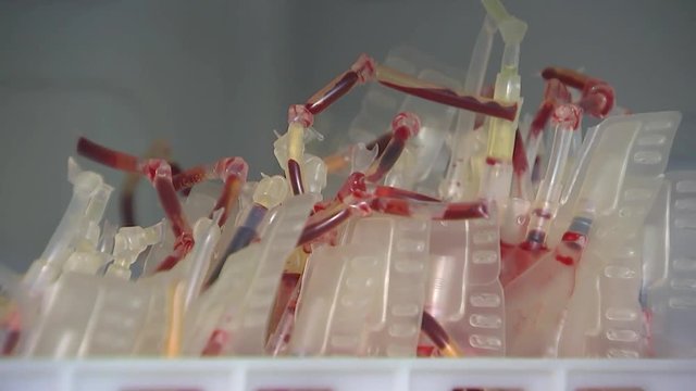Frozen donor blood