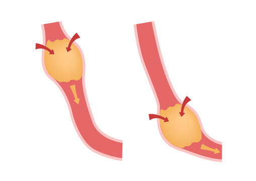 Digestion And Peristalsis Vector / Intestine