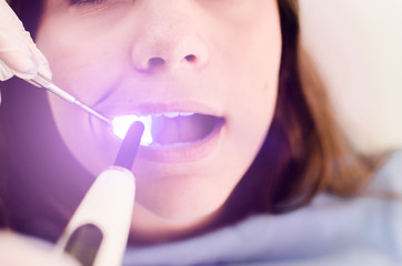 Patient at dentist getting seal done