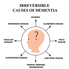 Obraz premium Irreversible causes of senile dementia. Alzheimer's disease. Infographics. Vector illustration on isolated background