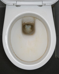 close-up of dirty toilet bowl with urine scale
