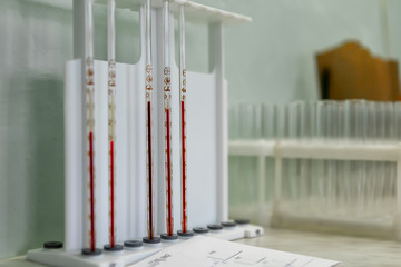 Laboratory equipment for blood analysis. The real work of the laboratory assistant in the hospital.