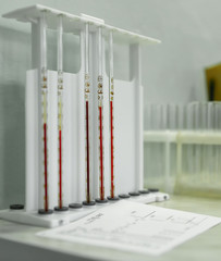 Laboratory equipment for blood analysis. The real work of the laboratory assistant in the hospital.