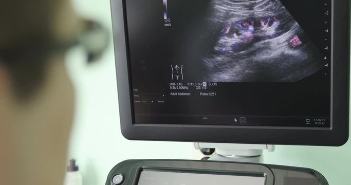 A male doctor looks at the ultrasound screen in a modern clinic.