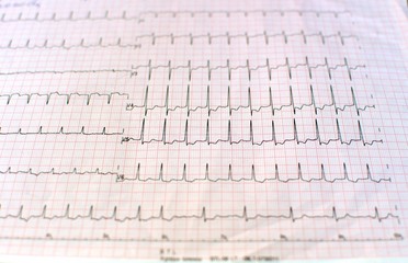 Close up of an electrocardiogram in printed paper form for health care and medical concept. EKG or...
