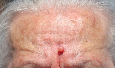 Forehead of an old grandmother as a background