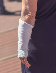 Obraz na płótnie Canvas A broken arm in a woman's cast
