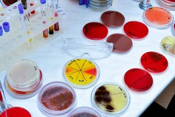 Petri dish. Microbiological laboratory. Mold and fungal cultures. Bacterial research