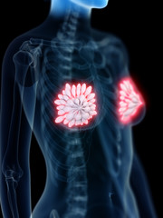 3d rendered medically accurate illustration of an inflamed mammary glands