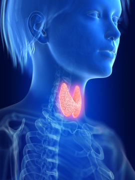 3d rendered medically accurate illustration of an inflamed thyroid