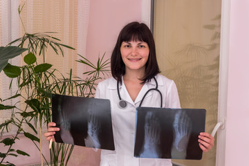 Smiling doctor with patient's x-ray in hands
