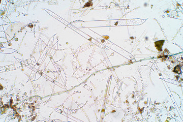 Marine aquatic plankton under microscope view