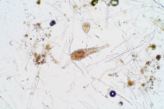 Marine aquatic plankton under microscope view