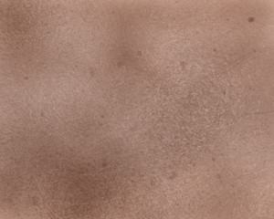 Texture Broken skin, Sunburning skin
