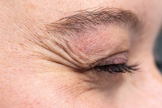 Wrinkled eye of young woman showing crow's feet