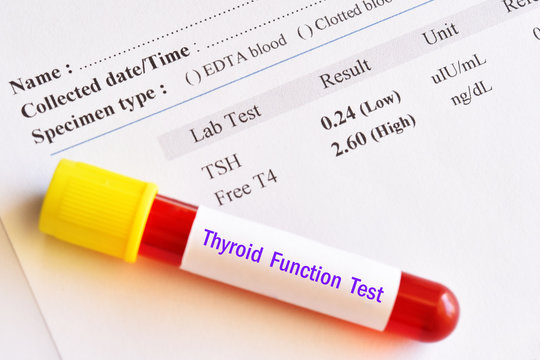 Hyperthyroidism result with blood sample tube