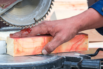 Injury when working with a saw. Place for your text.