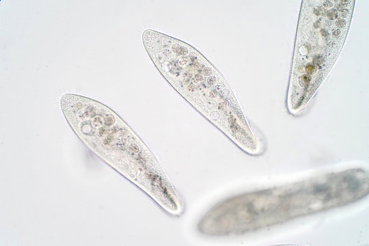 ciliates under microscope