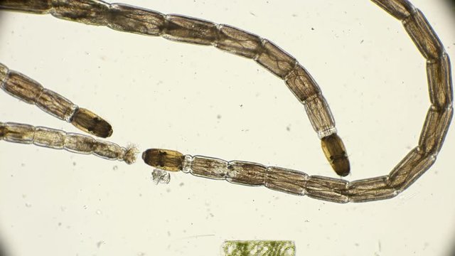 larva biting midges of the family Keratopogonidae under a microscope