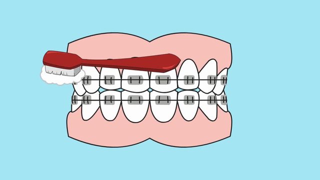 Dental Care - Vector Animation