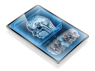 Modern medical tablet displaying brain scan