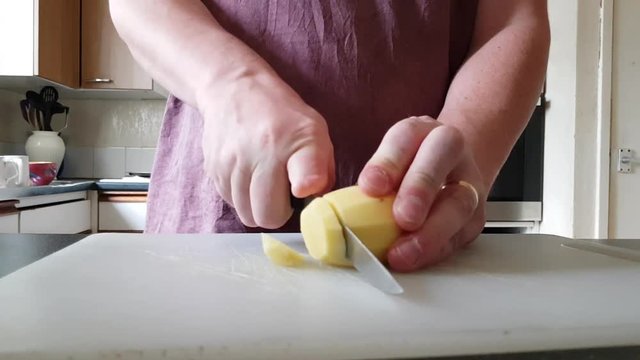 Male with a partially amputated index finger on his right hand slices a patato with a knife.