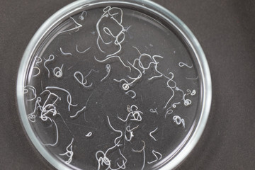 Ascariasis is a disease caused by the parasitic roundworm Ascaris lumbricoides for education in laboratories.