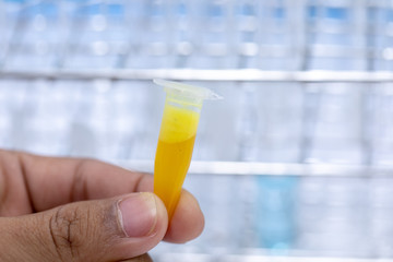 Analysis protein for study Chemical composition in laboratory.