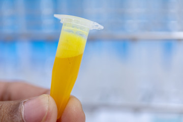 Analysis protein for study Chemical composition in laboratory.