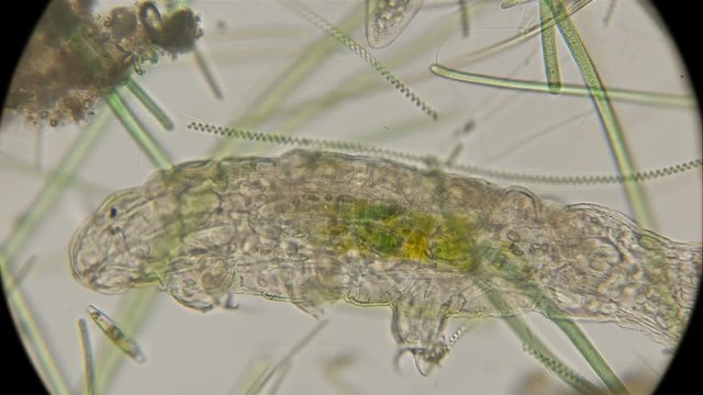 the most enduring organism on the planet is the thief, or the water bear Tardigrada, under a microscope