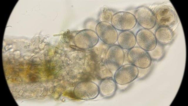 eggs of a water bear Tardigrada in a bag, under a microscope
