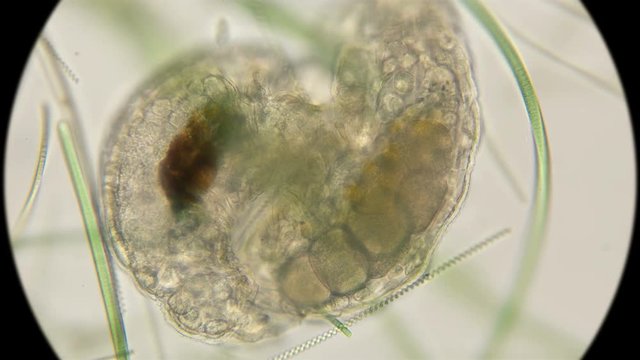 Mating of two silent Tardigrada, rare frames under a microscope