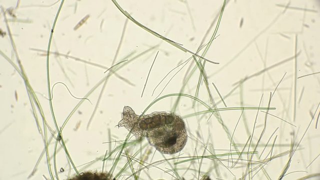 Mating of two silent Tardigrada, rare frames under a microscope