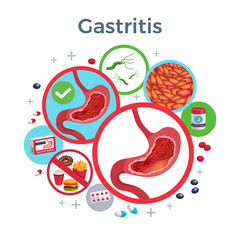 Gastritis Flat Composition 