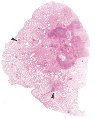 Cut through human tissue.