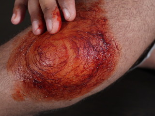 Red paste on Knee, Remedy for Knee Pain,Powerfull Organic Remedy for Knee and All Type Pain