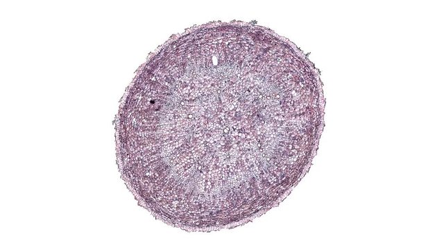 plasmodiophora brassicae root - cross section cut under the microscope &ndash; microscopic view of plant cells for botanic education