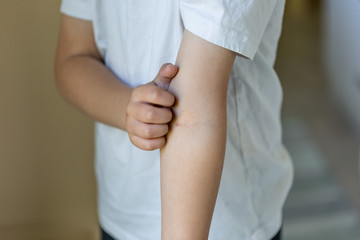 Young boy scratching his arm where he has eczma