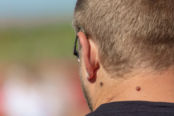 Ear on the head of a man