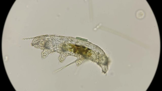 carcass of a dead water bear Tardigrada, under a microscope