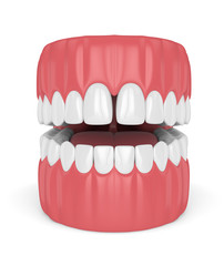 3d render of teeth with diastema