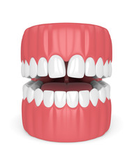 3d render of teeth with convergent diastema