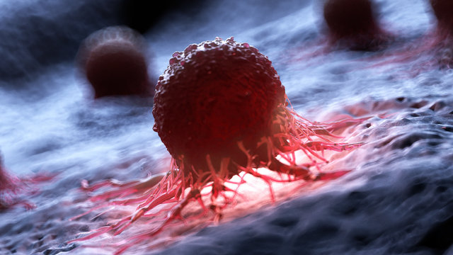 3d rendered illustration of a human cancer cell